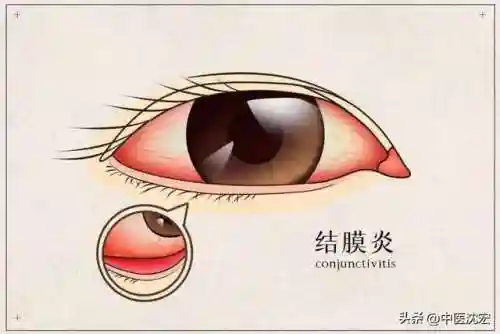 逍遥丸有什么功效(女性常吃逍遥丸的好处)插图6