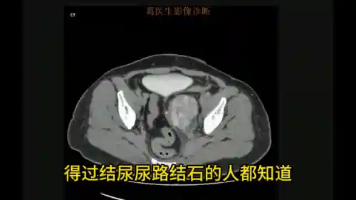头像女下半部位图片透明高清(女裤头图片里拍)插图6
