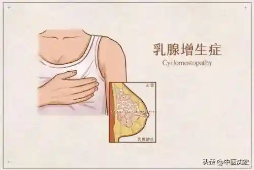 逍遥丸有什么功效(女性常吃逍遥丸的好处)插图8