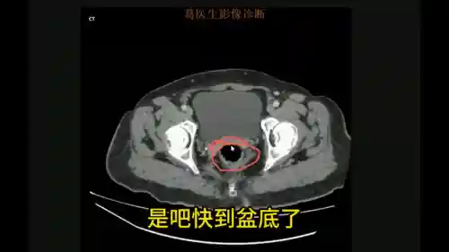 头像女下半部位图片透明高清(女裤头图片里拍)插图3