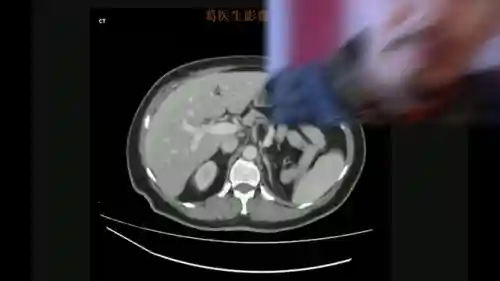 头像女下半部位图片透明高清(女裤头图片里拍)插图4