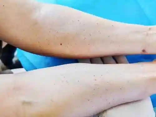 穿越火线女生去掉小内皮肤的方法(穿越火线关小雨拔萝卜)