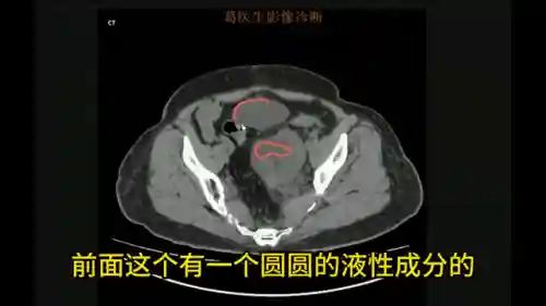 头像女下半部位图片透明高清(女裤头图片里拍)