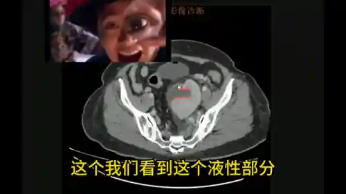 头像女下半部位图片透明高清(女裤头图片里拍)插图2