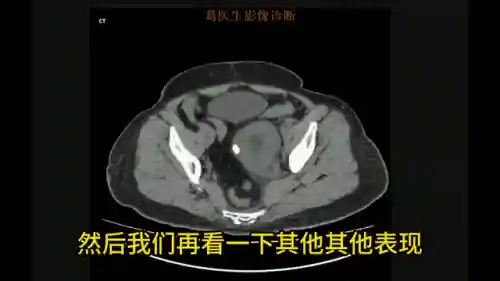 头像女下半部位图片透明高清(女裤头图片里拍)插图5