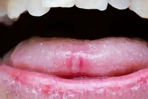吃菠萝蜜的7大禁忌(不能和什么一起吃的食物)插图2