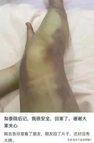 李智汉金宥娜(德鲁纳酒店金宥娜用什么换了花)插图20