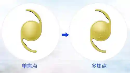 人工之眼强力阵容搭配(人工义眼)插图2