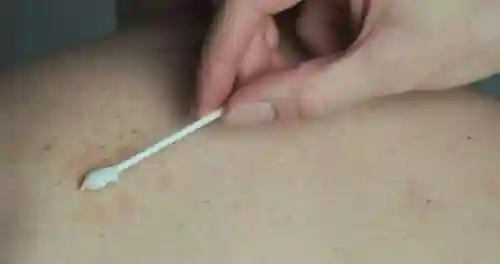 阴虱这两个字怎么念(阴虱子和虱子有什么区别)插图8