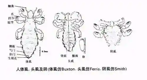 蜱虫和阴虱的图片(阴虱子是怎么长出来的)插图1 蜱虫和阴虱的图片(阴虱子是怎么长出来的)插图1
