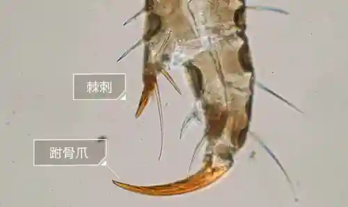 蜱虫和阴虱的图片(阴虱子是怎么长出来的)插图2 蜱虫和阴虱的图片(阴虱子是怎么长出来的)插图2