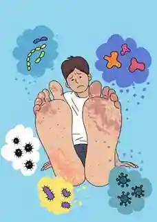 怎样判断是不是脚气(脚气是怎么传染的)插图2