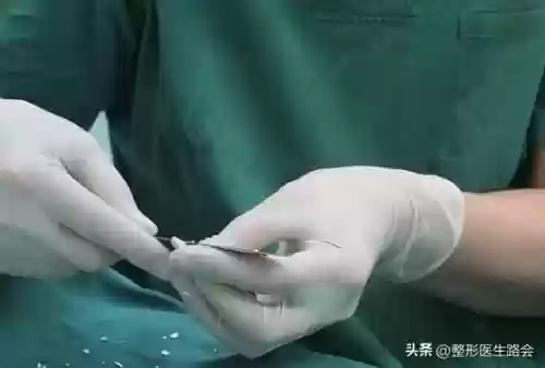 阵容手术图片(全麻手术图片真实)插图2