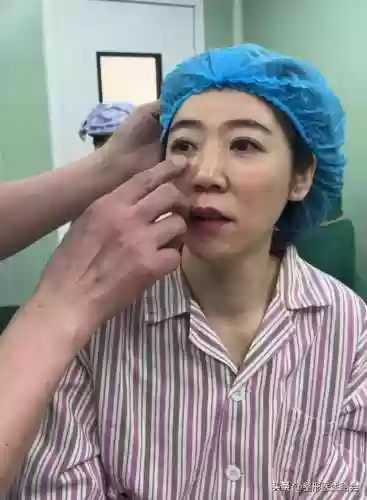 阵容手术图片(全麻手术图片真实)插图1