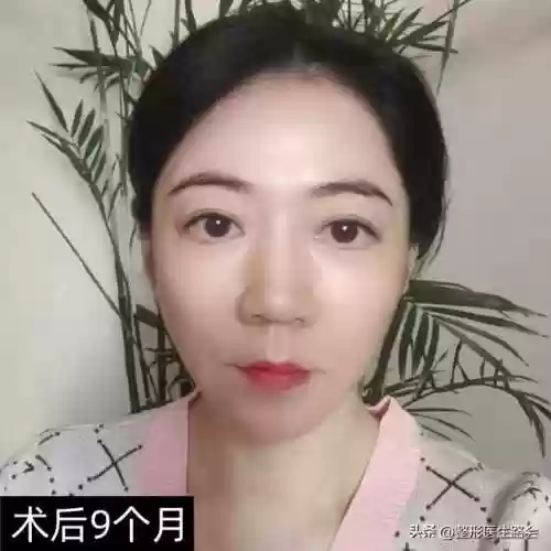 阵容手术图片(全麻手术图片真实)插图9
