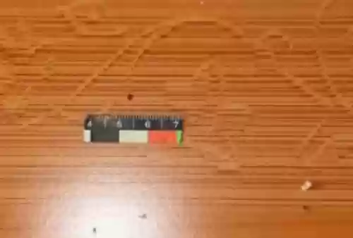 巨人观图片(法医为什么害怕巨人观)插图17 巨人观图片(法医为什么害怕巨人观)插图17