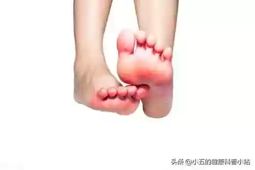 脚气烂脚趾缝痒溃烂如何治疗(脚气发病原因)插图1