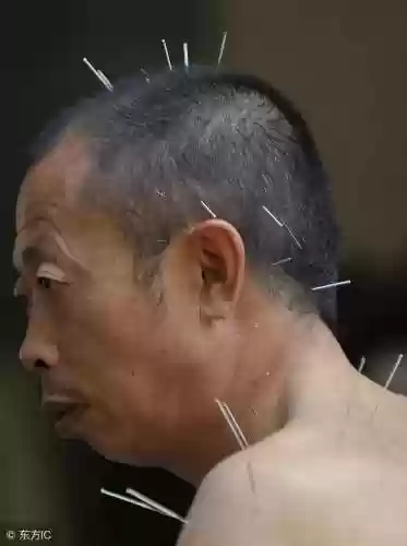 乱斗扁鹊禁忌阵容(最毒扁鹊出装)插图4
