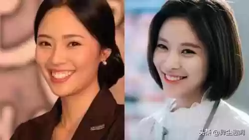 韩国牙阵容(韩国牙齿种植体哪个牌子好)插图8