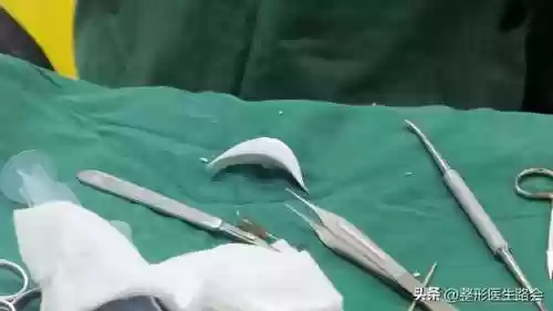 脸阵容效果(王者荣耀速推流阵容)插图1