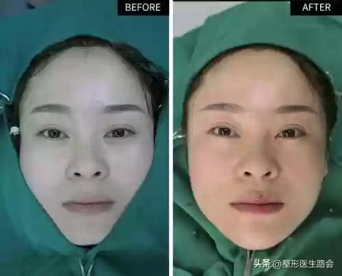 脸阵容效果(王者荣耀速推流阵容)插图3