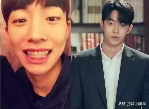 韩国牙阵容(韩国牙齿种植体哪个牌子好)插图2
