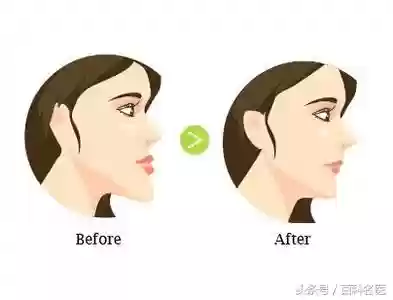 阵容改脸型(改变脸型方法)插图3 阵容改脸型(改变脸型方法)插图3