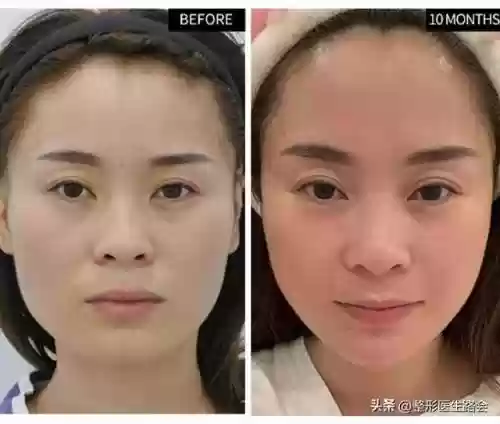 脸阵容效果(王者荣耀速推流阵容)插图5
