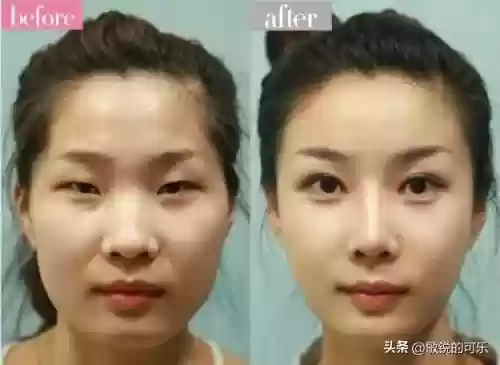 悲伤蛙阵容(宝可梦t0阵容)插图2