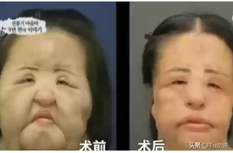 阵容鼻子韩国(韩日世界杯韩国队阵容)插图25