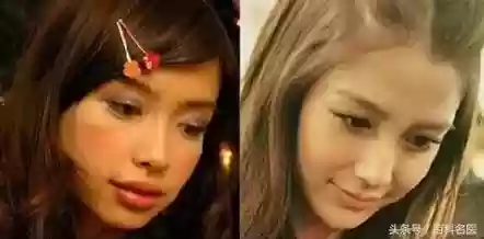 阵容改脸型(改变脸型方法)插图1 阵容改脸型(改变脸型方法)插图1