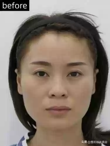 脸阵容效果(王者荣耀速推流阵容)