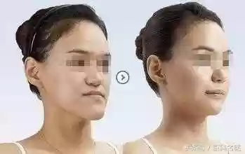阵容改脸型(改变脸型方法)插图4 阵容改脸型(改变脸型方法)插图4