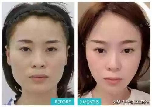 脸阵容效果(王者荣耀速推流阵容)插图4